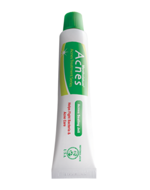 Sealing Gel
