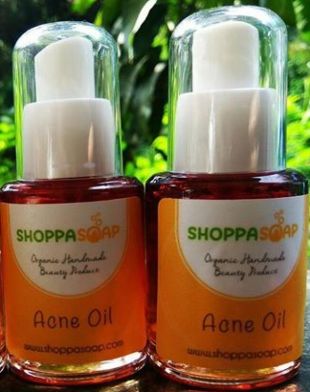 Shoppasoap Acne Oil Green (Binahong Extract)