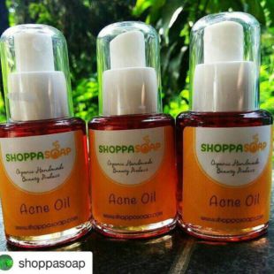 Shoppasoap Acne Oil Turmeric 