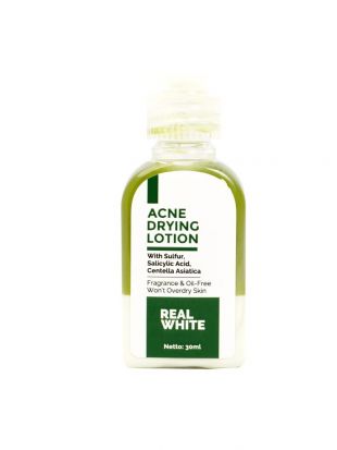 Real White Acne Drying Lotion 