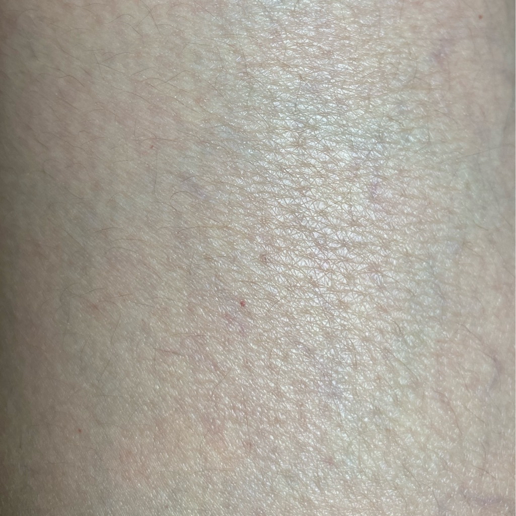 Illipe Retinol Body Serum imgfdn-59fc3b08-4b9c-4201-8834-c5a0b6afd191