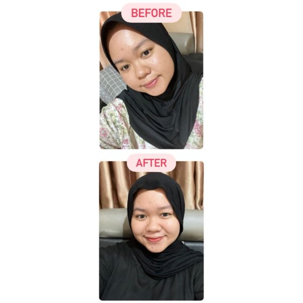 Ultimate Vibrant Skin imgfdn-adda8b9c-b63b-43e2-bf48-e1ad892d7c89