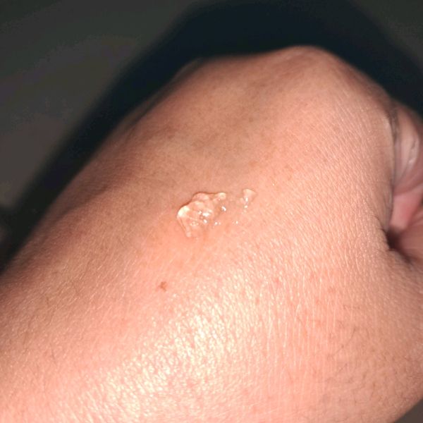 Niacef (Nicotinamide 4%) imgfdn-374b011c-9d0f-4095-b365-668d177b9d6c