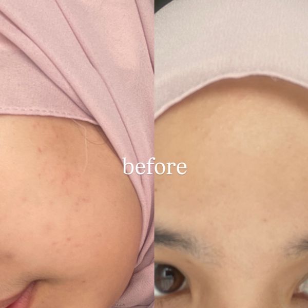 Ultimate Vibrant Skin imgfdn-9bc92a79-be17-4093-86c6-5dccc5298d33