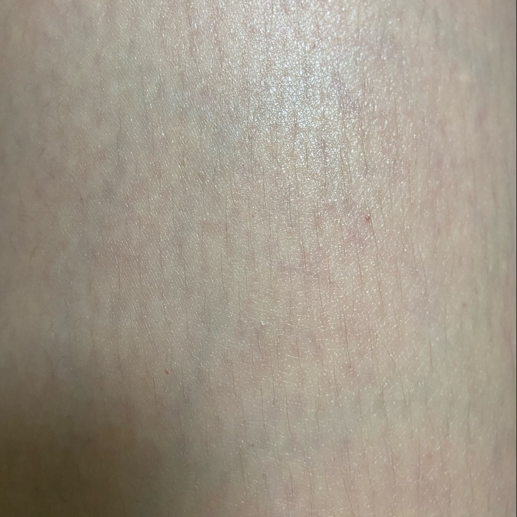 Illipe Retinol Body Serum imgfdn-c5234792-c824-48a0-bd04-1b8872a87456