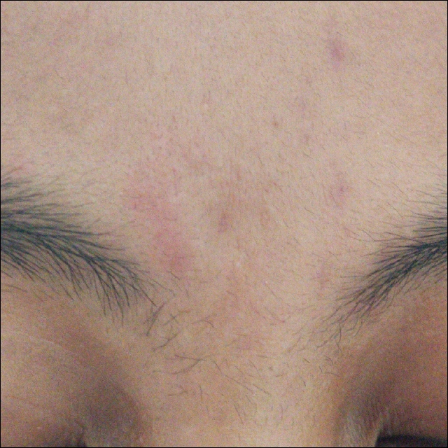 HPR Retinal Serum imgfdn-bf8dff67-4cc9-49be-94bb-b10d2897a0cd