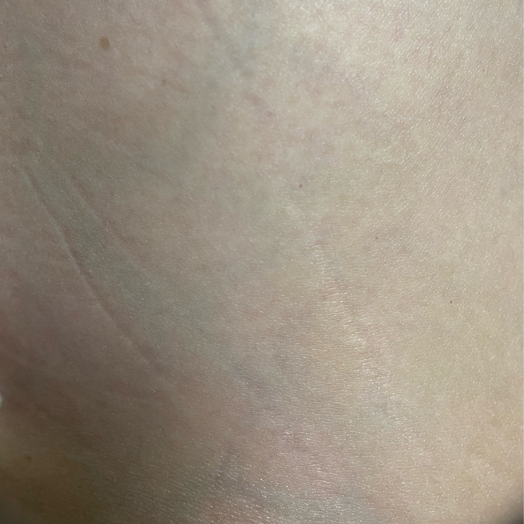 Illipe Retinol Body Serum imgfdn-78858513-5a9c-465b-ba1b-69f152a14c9e